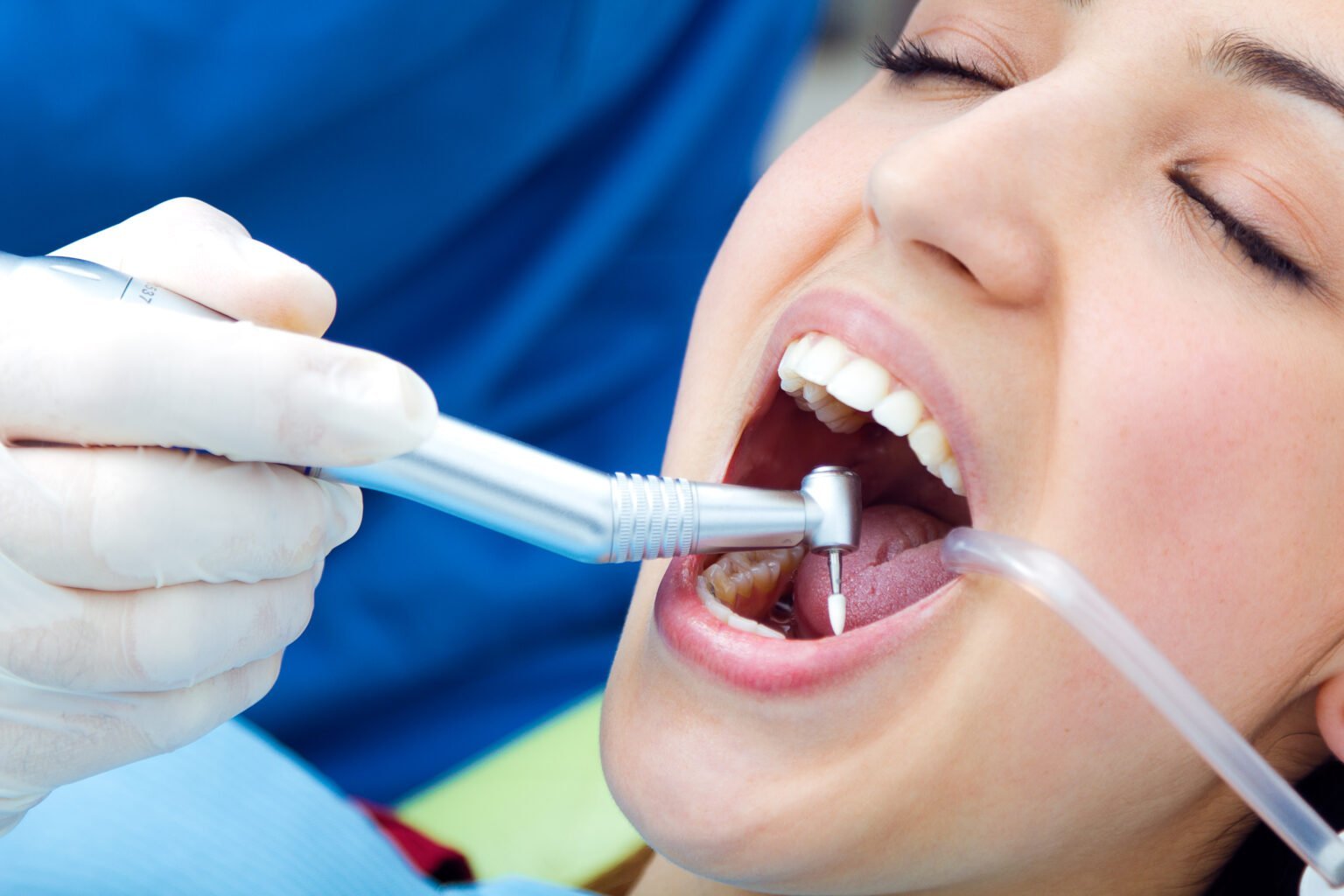 Aesthetic smile makeover in Bangalore